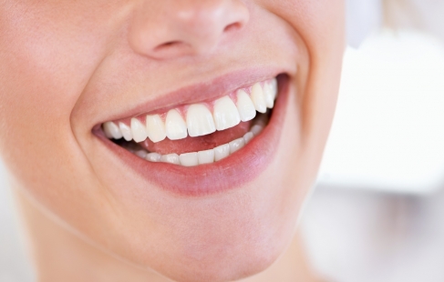 Et blændende smil